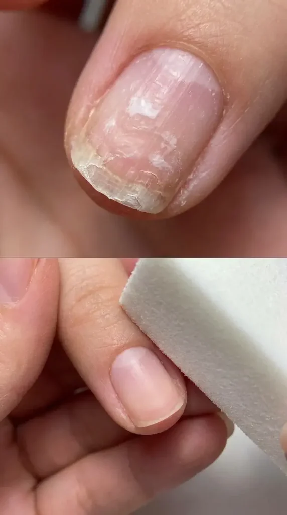 Your Natural Nails Will Finally Breathe